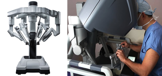 Robotic & Laparoscopic Colectomy